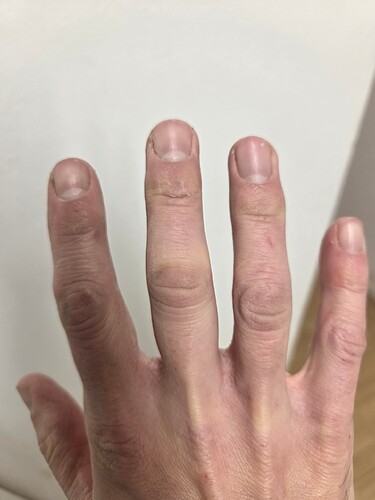 1764151489075935417994652847768