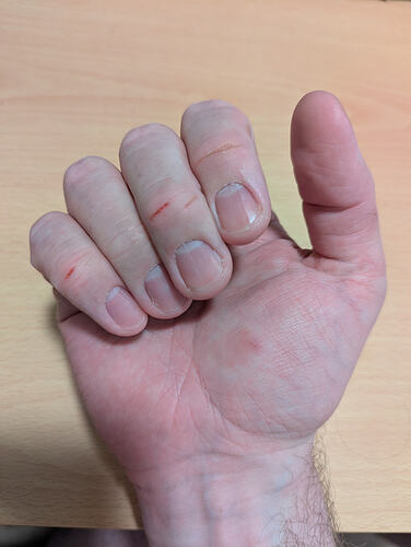 PXL_20260303_171126240